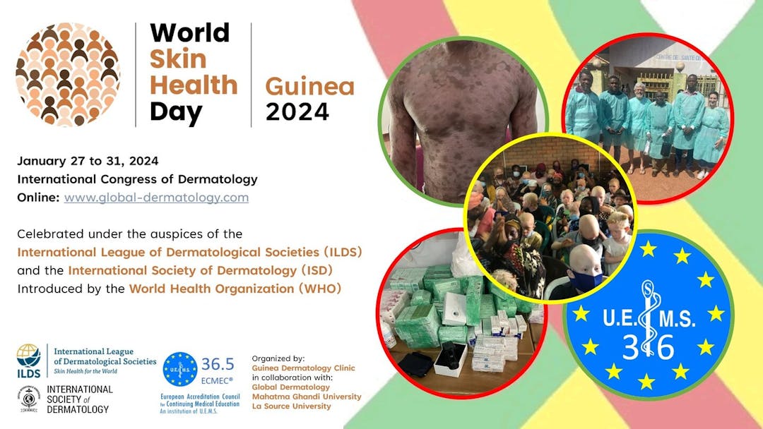 World Skin Health Day | Guinea 2024